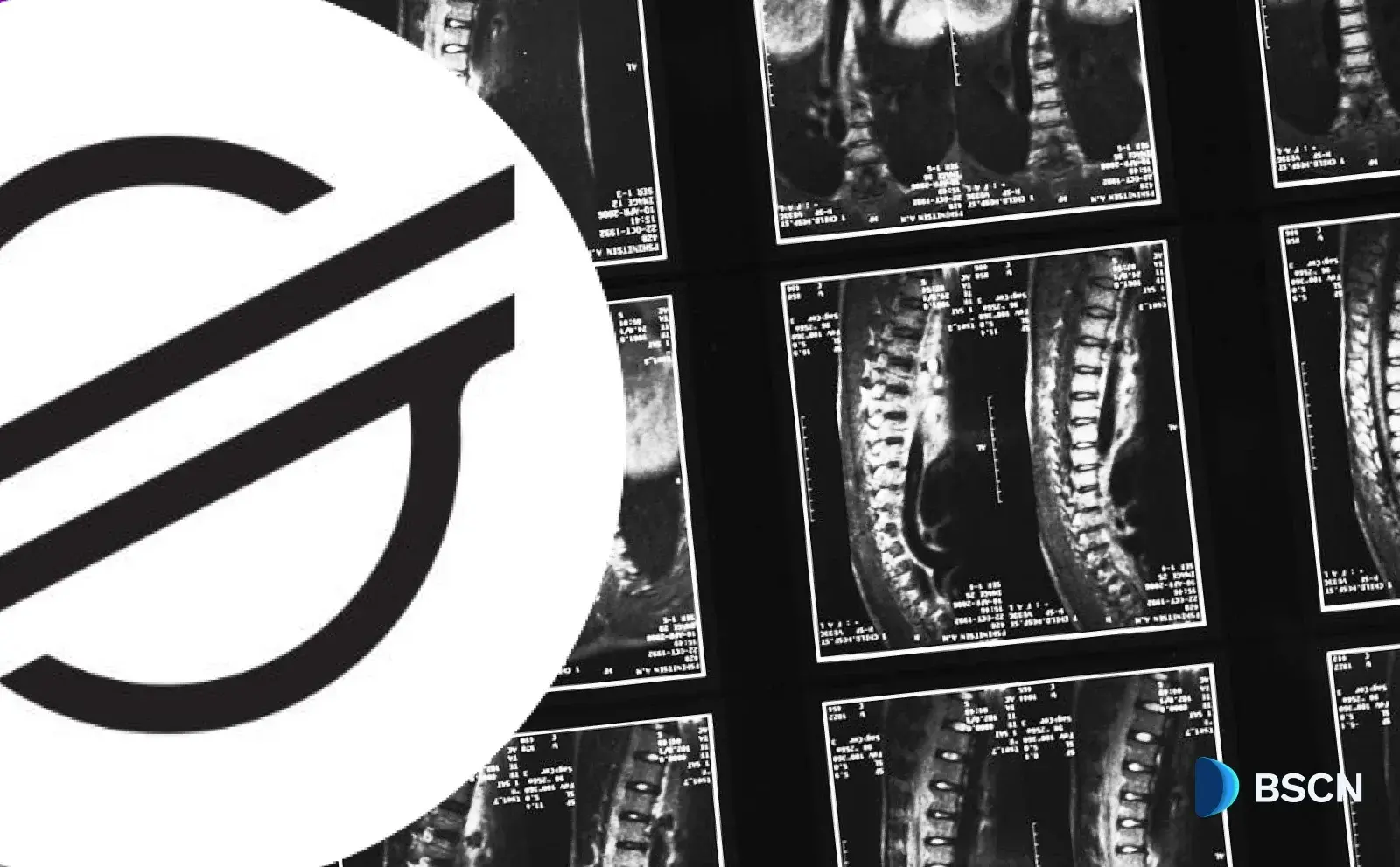 Stellar Network นำเสนอความเป็นส่วนตัวด้วย Protocol X-Ray ในการอัปเกรดเครือข่ายหลัก