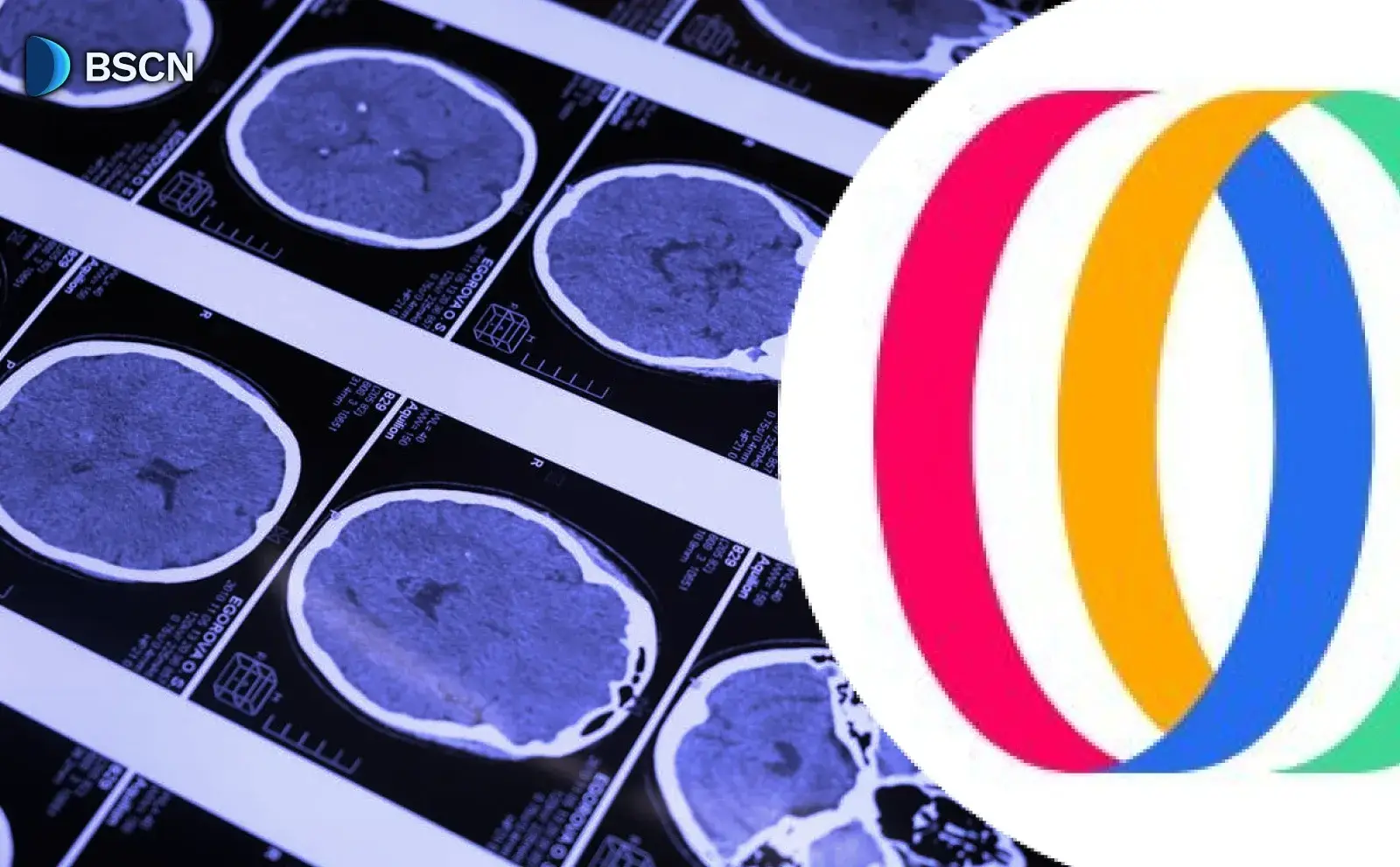 What is Openmind: Exploring the AI Platform Enhancing Real-world Intelligence with its OM1 OS